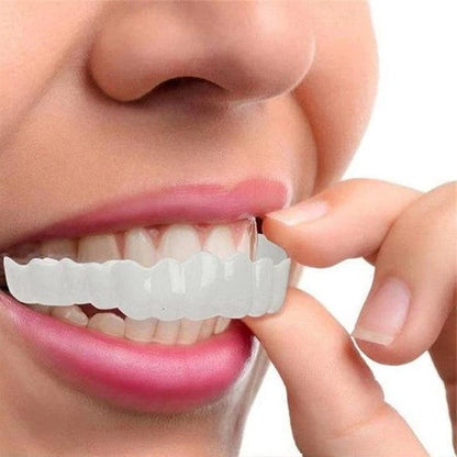 Veneers For Upper And Lower Teeth Complete Smile Transformation Kit