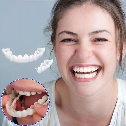 Veneers For Upper And Lower Teeth Complete Smile Transformation Kit