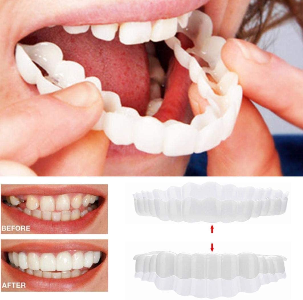 Veneers For Upper And Lower Teeth Complete Smile Transformation Kit