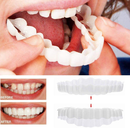 Veneers For Upper And Lower Teeth Complete Smile Transformation Kit