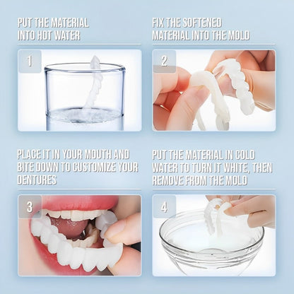 Veneers For Upper And Lower Teeth Complete Smile Transformation Kit