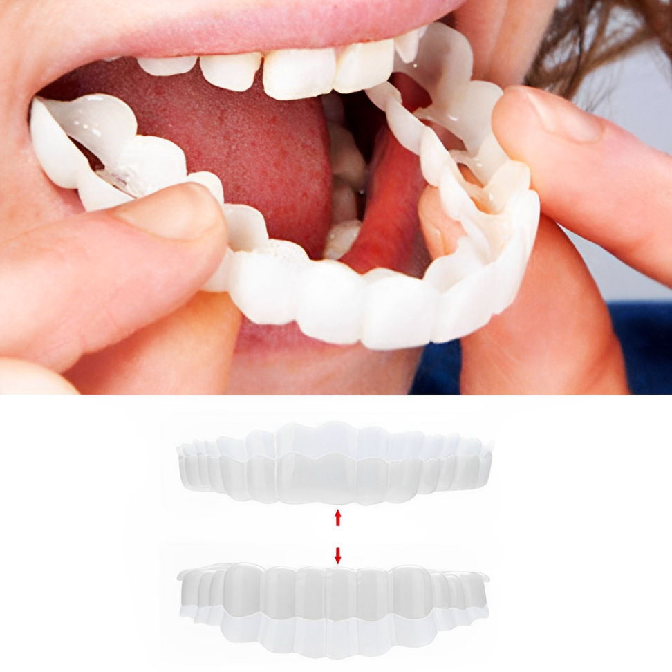 Veneers For Upper And Lower Teeth Complete Smile Transformation Kit