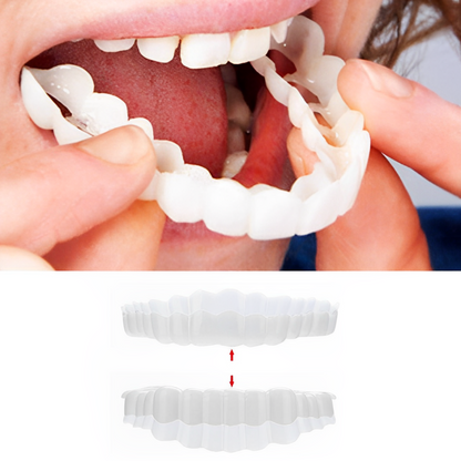 Veneers For Upper And Lower Teeth Complete Smile Transformation Kit