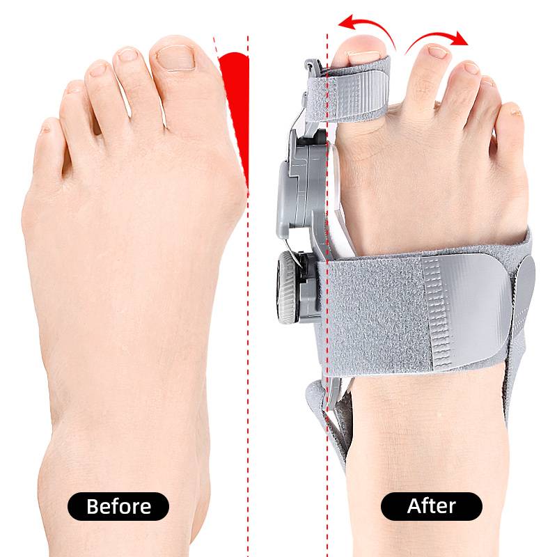 Bunion Corrector Toe Spacer For Natural Toe Alignment And Comfort