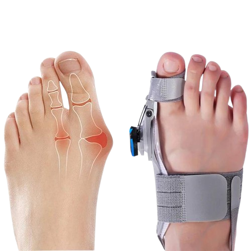 Bunion Corrector Toe Spacer For Natural Toe Alignment And Comfort